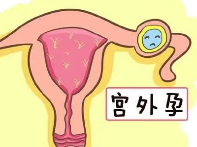 警惕！這些女性更易患宮外孕