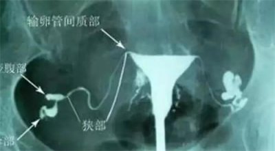 給高齡備孕女性的忠告：5個誤區(qū)，提前知道！